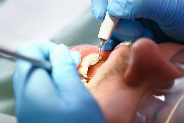 Best Weekend Emergency Dentist in White House Station, NJ